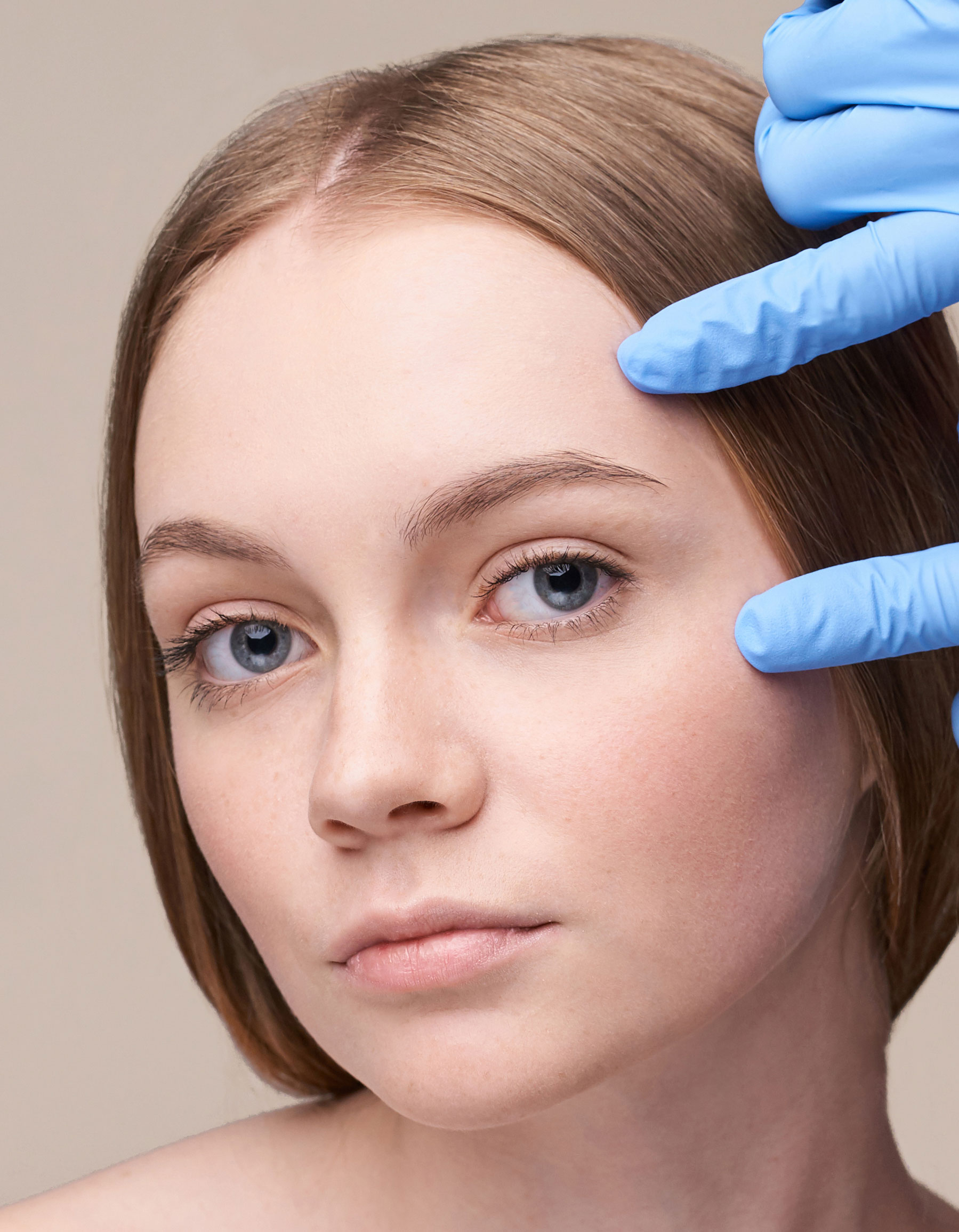 Upper eyelid blepharoplasty Form MD Plastic Surgery Facelift